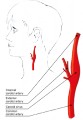 A slight dilation (widening) of the proximal part of the internal carotid artery. 


 


The carotid sinus is sensitive to pressure changes in the arterial blood at this level.