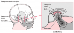 Divides the temporomandibular joint cavity into two separate synovial compartments