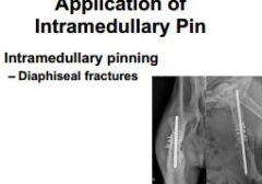 The IM pin (pic) alone will result in failure.


 


whatever