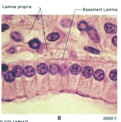 -disorganized, loose connective tissue
-nuclei lined up at same distance from basal lamina