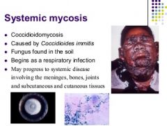 - Coccidioidomycosis
systemic disease involving:
- meninges, bones, joints, s/c and cutaneous tissues