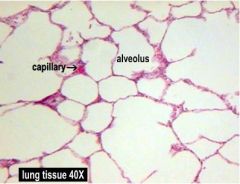 Lung epithelium
-thin, simple squamous epithelium
-mostly voids
-alveoli are the point of O2/CO2 exchange