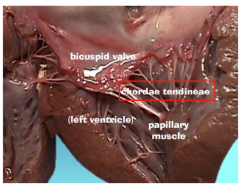 Connect valve leaflets to papillary muscles