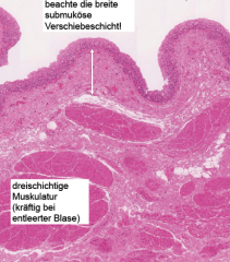 Histo: 3 netzartig verbundene Muskelschichten; Urothel mit Crusta

