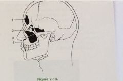 The structure labeled #2 is the
A. Maxillary sinus
B. Sphenoidal sinus
C. Ethmoidal sinus
D. Frontal sinus