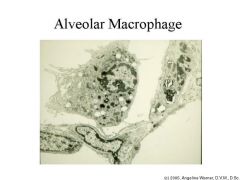 Alveolar Macrophages