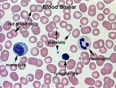 Other Types of white blood cells:
-lymphocyte - same size as RBC, mostly nucleus
-neutrophil - multi-lobed nucleus
-platelets - dark spots