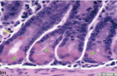 What are the cells labeled a in this section of a duodenum?