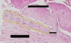 Identify the labeled parts of the large intestine