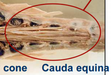 Collection of spinal roots that stream caudally from end of spinal cord and occupy vertebral canal