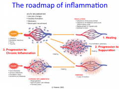 Healing
Progression to Suppuration
Progression to Chronic Inflammation
What follows
The extent of damage caused to the tissue cells
Whether the causal agent is eliminated or whether it persists and continues to cause further damage and provoke fur...