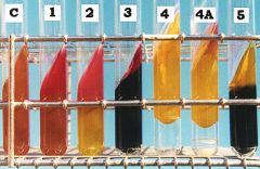 29#Triple Sugar Iron Test
What agar is used