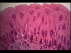 -lumen of jejenum
- nucleus
- basement membrane
- microvilli or cilia
- goblet cell