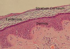 - stratum corneum
- stratum lucidum
- stratum granulosum
- stratum spinosum
- stratum basale
- dermis
- reticular region
- papillary region
- sebaceous gland
- hair follicle/root
- dermis