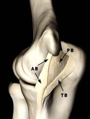 At the elbow, the anterior bundle of the medial collateral ligament inserts at which site?


1.  Radial tuberosity


2.  3mm distal to the tip of the coronoid


3.  Anteromedial process of the coronoid


4.  Medial border of the ol...