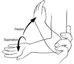 nursemaid elbow radial head subluxation with interposition of the annual ligament
the arm is flexed and the forearm is pronated
Supinate the forearm and flex the elbow past 90°