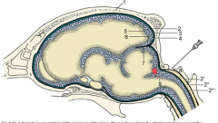 Area between cerebellum and medulla oblongata


(where the star is)


 


*Can collect CSF from here


 