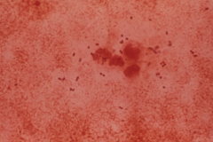 Organism Pattern Streptococcus Pneumoniae