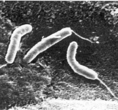 Curved gram (-) rod w/ flagella
Faculative aerobe or anaerobe
Commonly found in saltwater