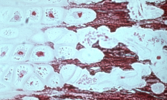 Mineralization of cartilage matrix in hypertrophic zone of physis