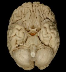 This view of the brain is called the ________ view.