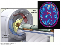 










•based
on rotating x-ray beam and detectors

•anatomical
imaging with a spatial resolution of millimeters