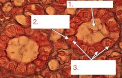3. What is lining the kidney tubules?