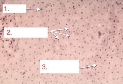 Where is this specific tissue located?