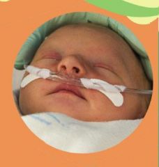 INFANT AND PEDIATRIC DEVICES
Nasal Cannulas