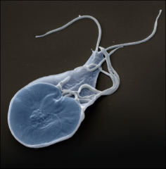 Flagellated protozoans 
Giardia