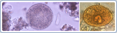 Ciliated protozoans 
Balantidiumcoli: (pigs)