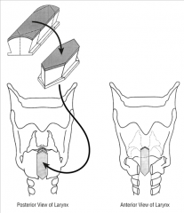Tx - tracheotomy, cricoid split or laryngotracheal reconstruction

(may be congenital, or secondary to intubation)