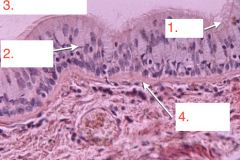 Identify the nuclei
