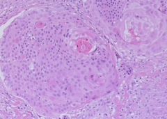 What is this a histology of?


What are the eosinophillic components