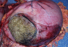 Evidence of antemortem gastric rupture