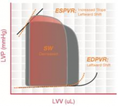 Hypertrophic Cardiomyopathy
- Thickening of the ventricular muscle → ↓ chamber compliance and ↑ LV pressures
- ↓ EDV and ↑ ESV → ↓ SV → ↓ CO

Exceptions:
- Healthy (athletes and healthy elderly) may have ↑ EDV and ↑ SV 
...