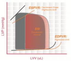 Dilated Cardiomyopathy
- Dilated ventricle without compensatory thickening of the wall
- LV unable to pump enough blood to meet metabolic demands
- ↑ ESV and ↑ EDV; pressures remain relatively unchanged
- ESPVR and EDPVR curves are shifted...