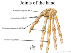 midcarpal joint: 
functional joint 
convex-concave 
condyloid type 
movement 
- flexion/extension 
radial deviation> ulnar deviation 
