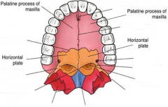 Made up of 4 bones: 


Palatine Processes of the maxillae (2)


Horizontal plates of the palatine bones (2)
