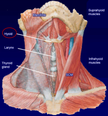 suprahyoids:
digastric (2 bellies)
stylohyoid
mylohyoid
geniohyoid


infrahyoids: (strap)
sternohyoid
omohyoid (2 bellies)
thyrohyoid
sternothyroid (no attachment to hyoid)