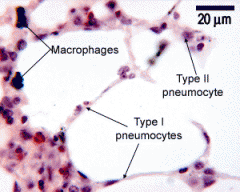 Type II pneumocytes