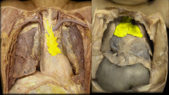 Anterior and superior to the heart , just posterior to the manubrium of the sternum, within the superior mediastinum