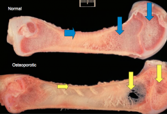 osteoporosis in a pig