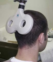 Transcranial magnetic stimulation (TMS) uses high-frequency magnetic pulses to target affected areas of the brain.
