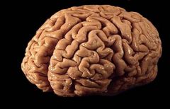 frontal lobe