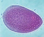 Tipas Sarcomastigophora
Potipis Opalinata


*Endo/ektoplazma, branduoliai, citoplazmos granulės, (žiuželiai, vagelės)
-gyvena varlės žarnyne