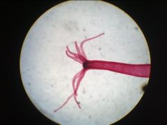 Tipas Cnidaria
Klasė Hydrozoa
*padas, gastralinė ertmė, liemuo, burna, čiuopikliai
pjūvis - dilgiosios, epitelio-raumeninės, intersticinės, ekto/endoderma
- daugialąstė, nelytinis (pumpuravimasis), lytinis - kai šalta