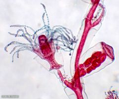 Tipas Cnidaria
Klasė Hydrozoa


*reprodukcinis polipas, medūzos, hidroteka, hidranto burna, gonoteka, teka, gastralinė ertmė, čiuopikliai
