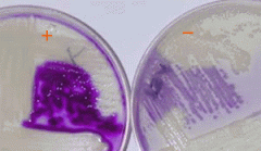 


Positive Result = Purple edging effect after Kovac's reagent is added

Negative Result= No edging effect after Kovac's reagent is added