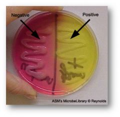 Positive Result= Growth of bacteria with a color change of the media to yellow


Negative Result= Growth of bacteria without a color change or no growth of bacteria ( Bacteria unable to tolerate high salt or unable to ferment mannitol)